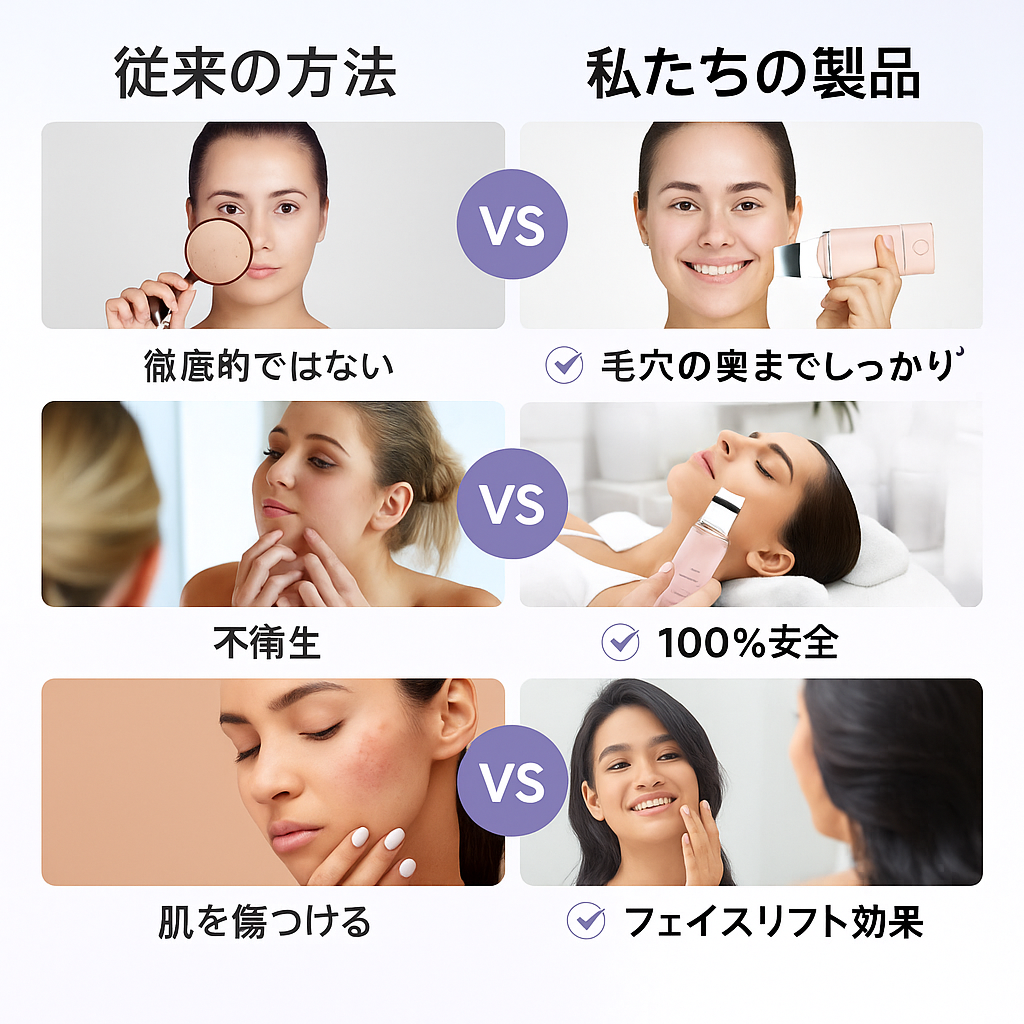 ANLAN 4in1 超音波スキンスクラバー – 毛穴洗浄・リフトアップ美顔器